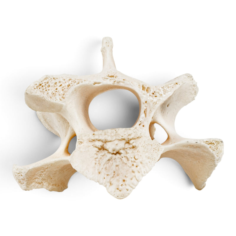 Real Wolf Vertebra - Pathology