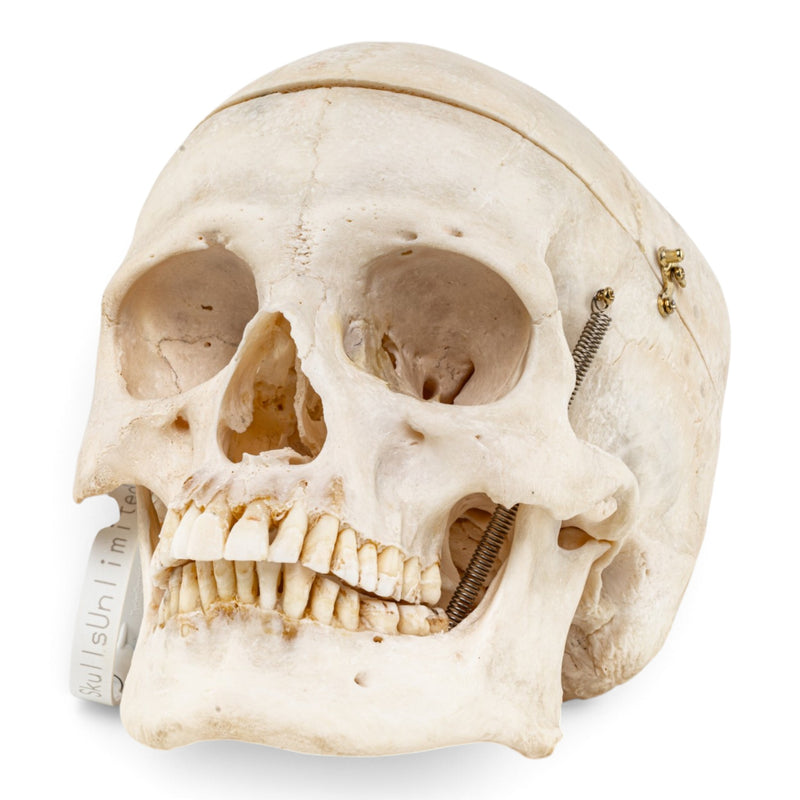 Real Human Skull