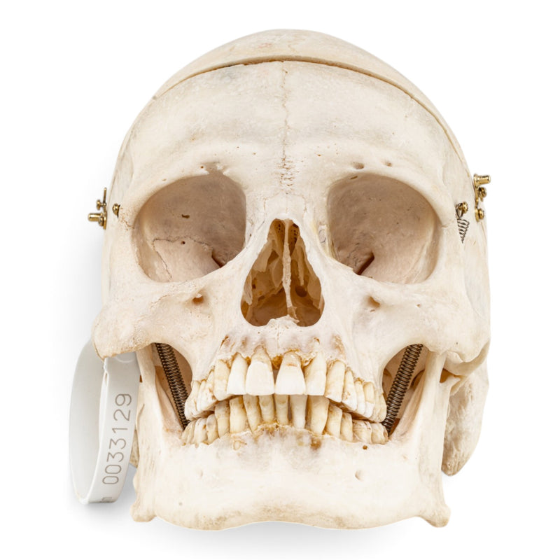 Real Human Skull