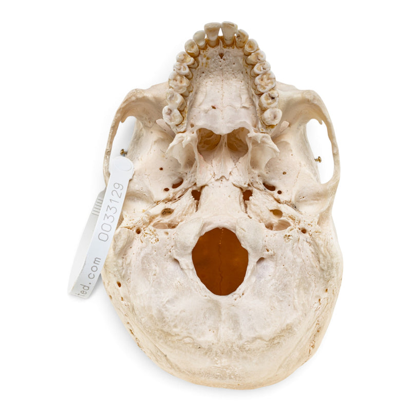 Real Human Skull