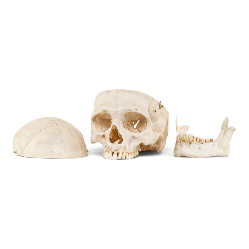 Real Human Skull