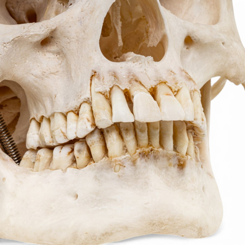 Real Human Skull