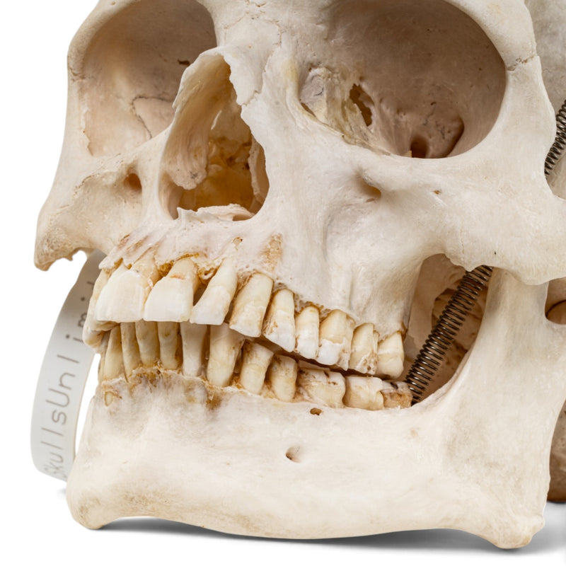 Real Human Skull