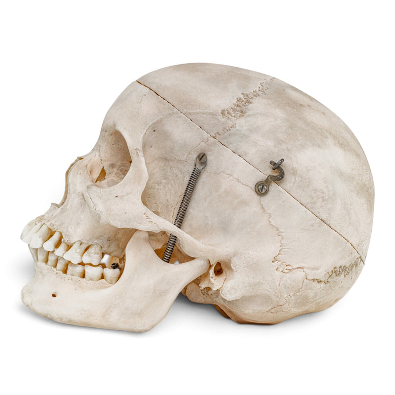 Real Human Skull