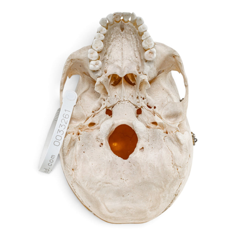 Real Human Skull