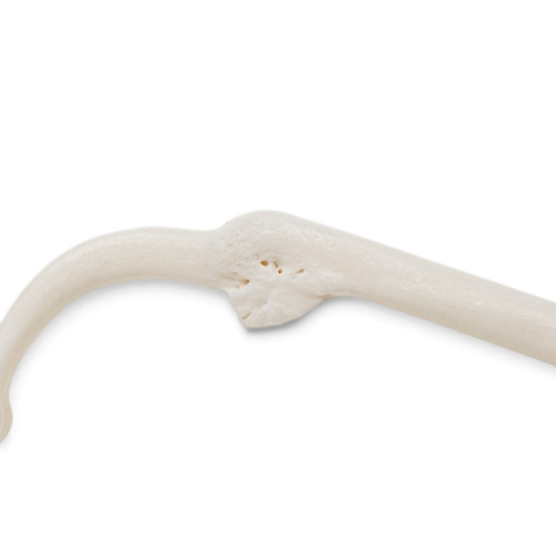 Real Raccoon Baculum - Healed Pathology