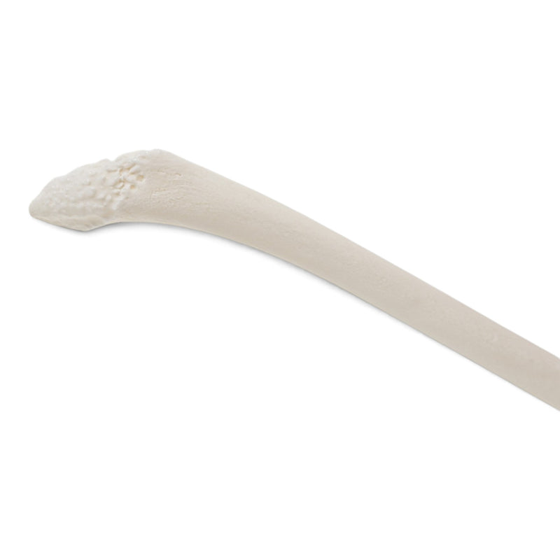 Real Raccoon Baculum - Healed Pathology