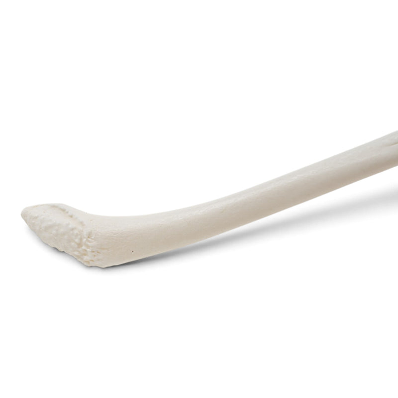 Real Raccoon Baculum - Healed Pathology