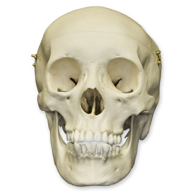 Replica Human Male Adolescent Skull with Calvarium Cut