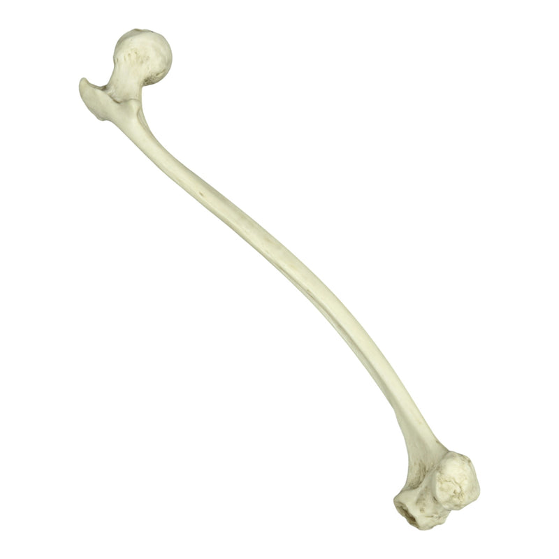 Replica Human Left Femur with Polio