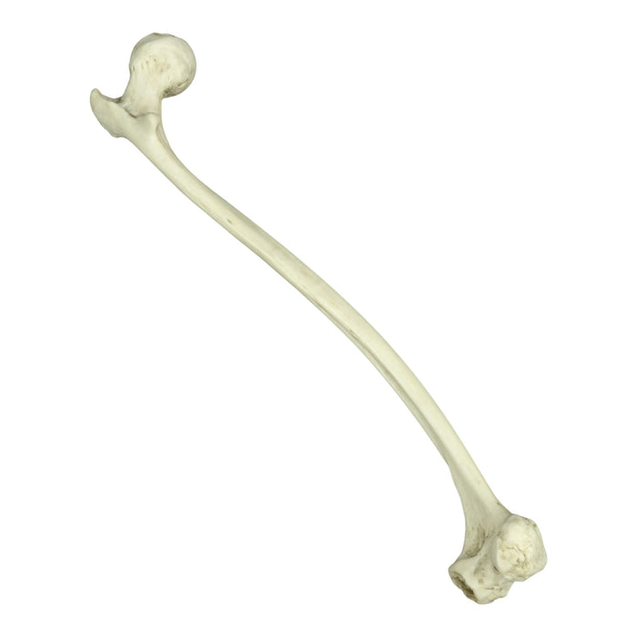 Replica Human Left Femur with Polio