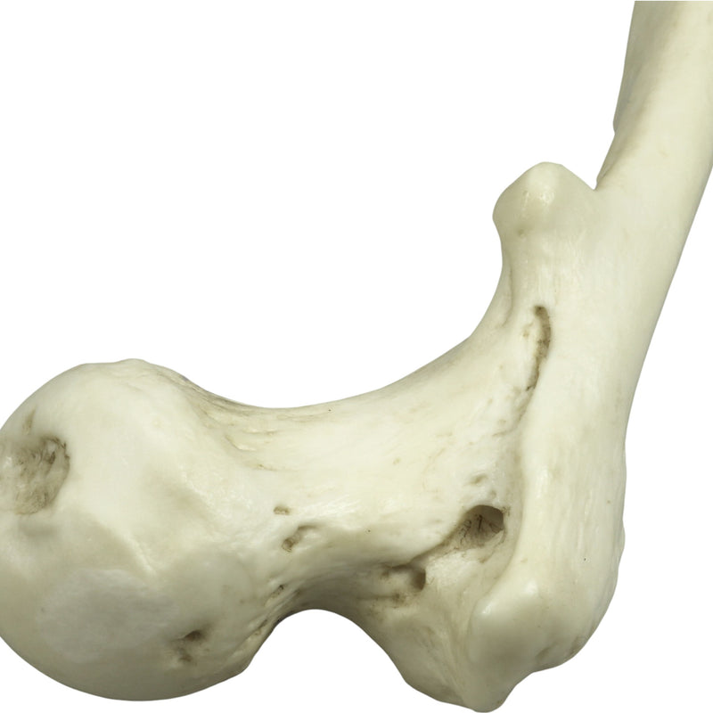 Replica Human Left Femur with Polio