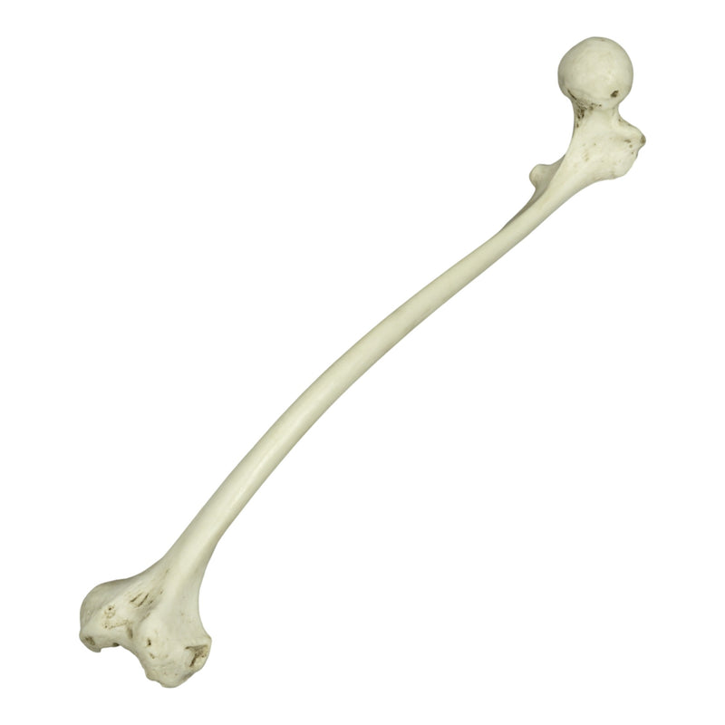 Replica Human Left Femur with Polio