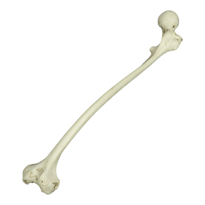 Replica Human Left Femur with Polio