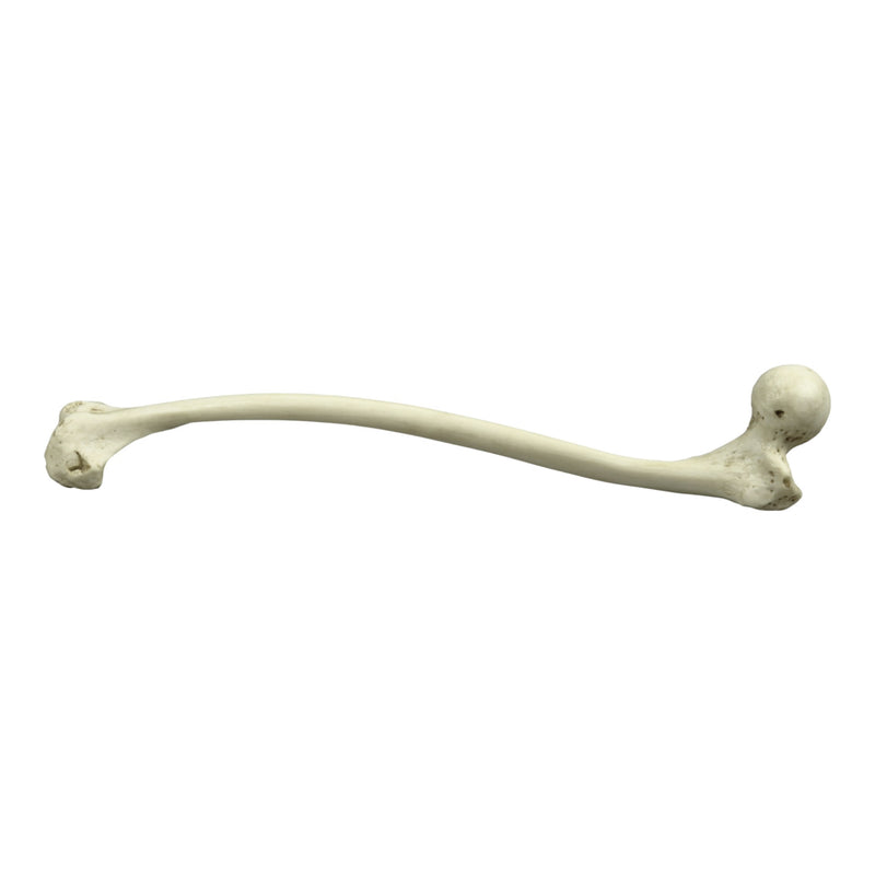 Replica Human Left Femur with Polio