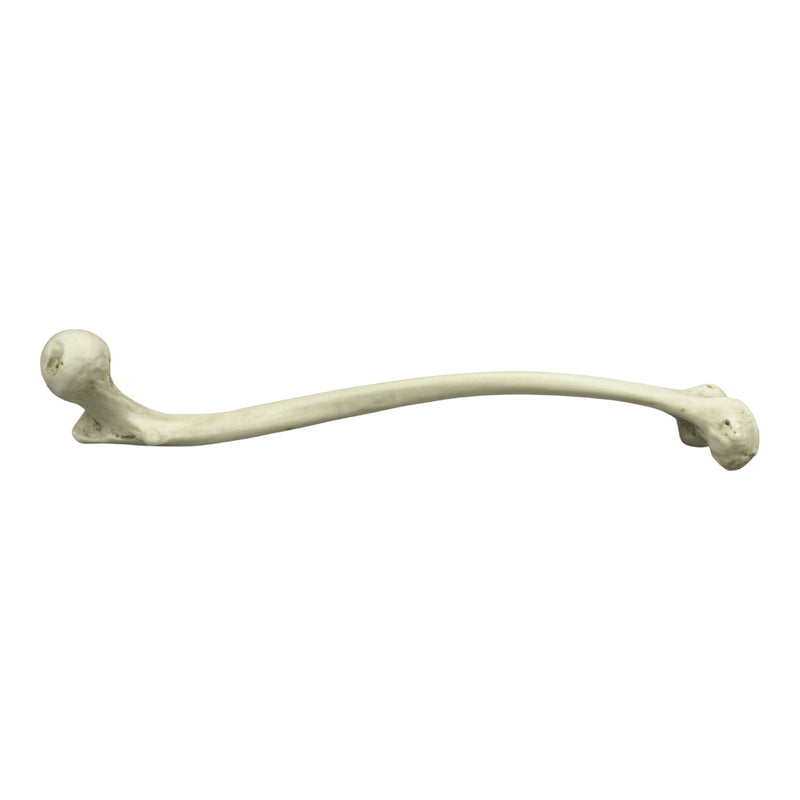 Replica Human Left Femur with Polio