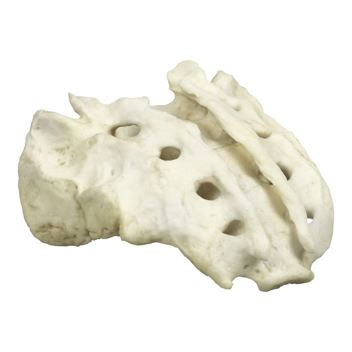 Replica Human Sacrum with Spina Bifida