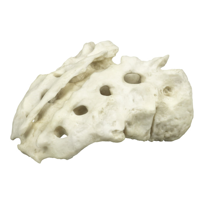 Replica Human Sacrum with Spina Bifida