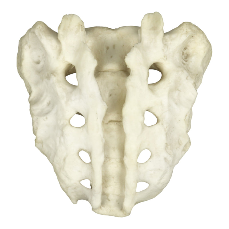 Replica Human Sacrum with Spina Bifida
