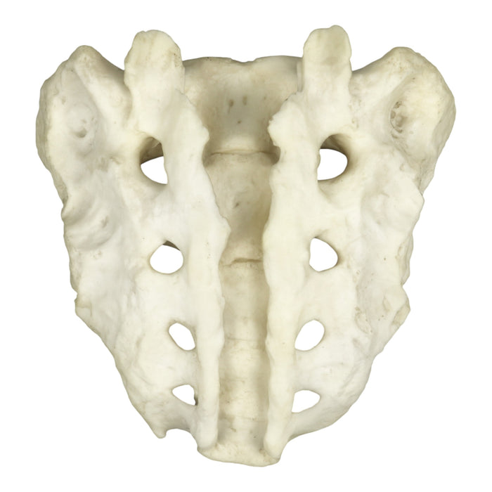 Replica Human Sacrum with Spina Bifida