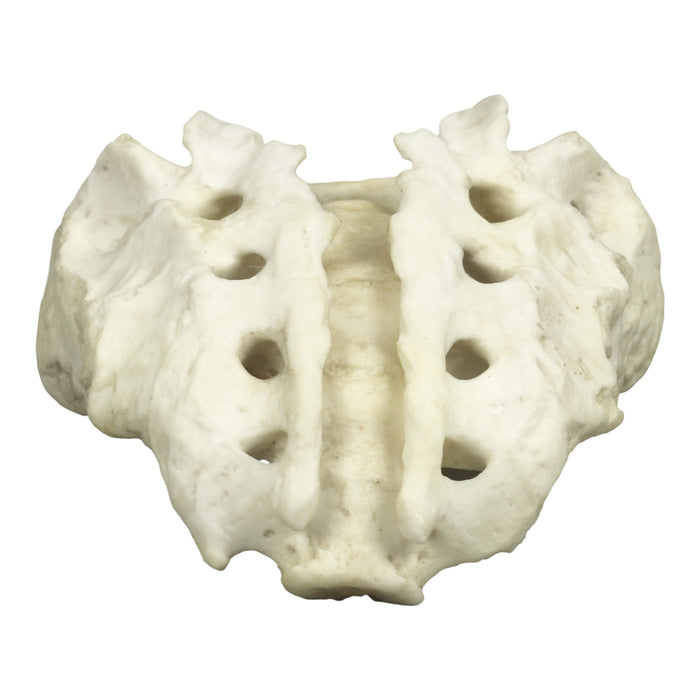 Replica Human Sacrum with Spina Bifida