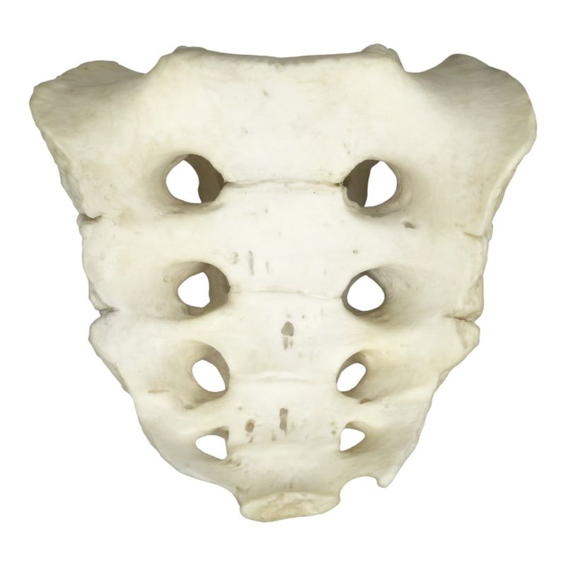 Replica Human Sacrum with Spina Bifida