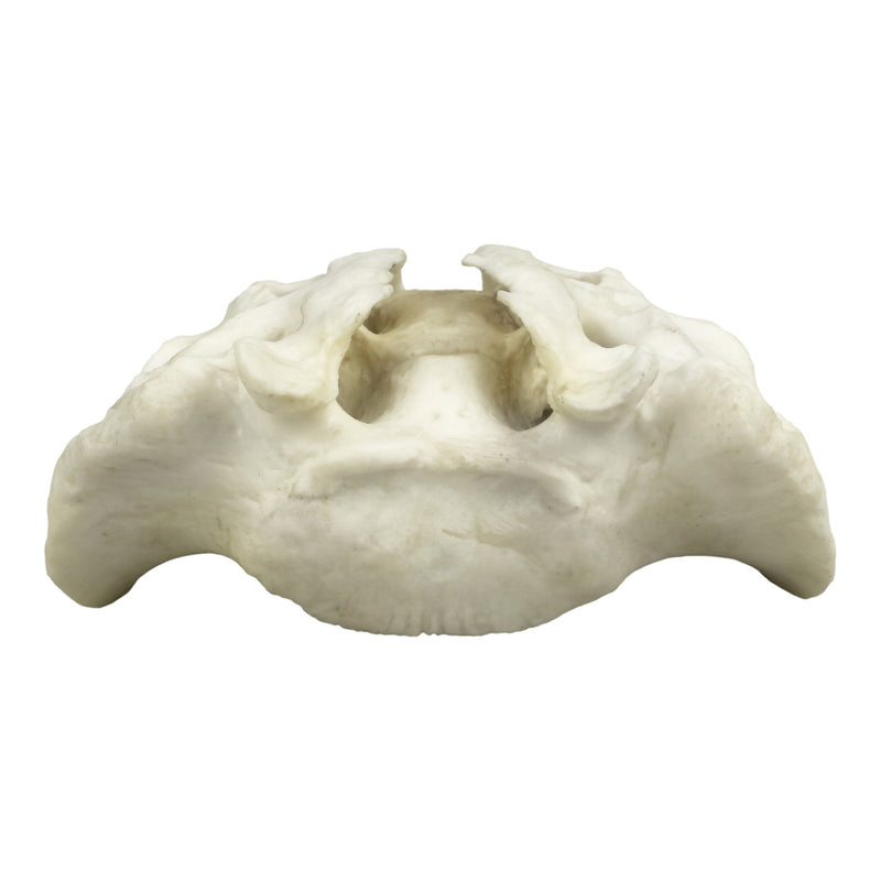Replica Human Sacrum with Spina Bifida