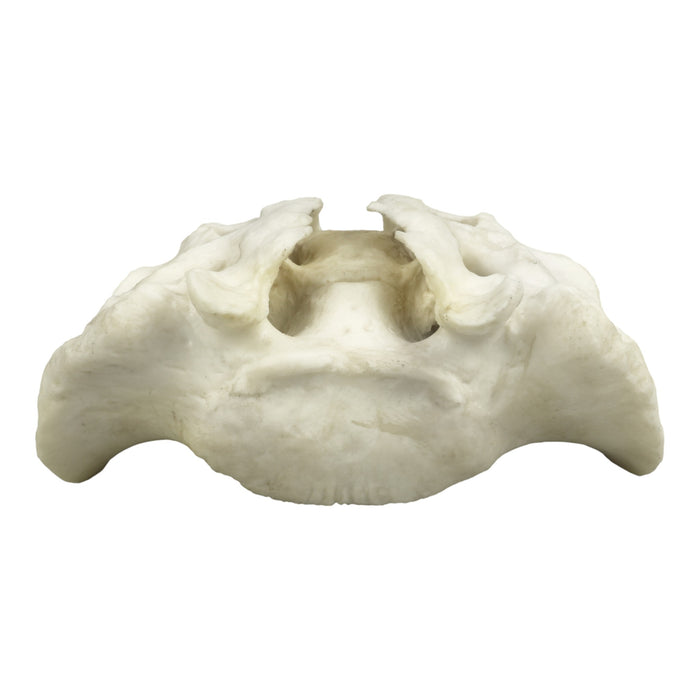 Replica Human Sacrum with Spina Bifida