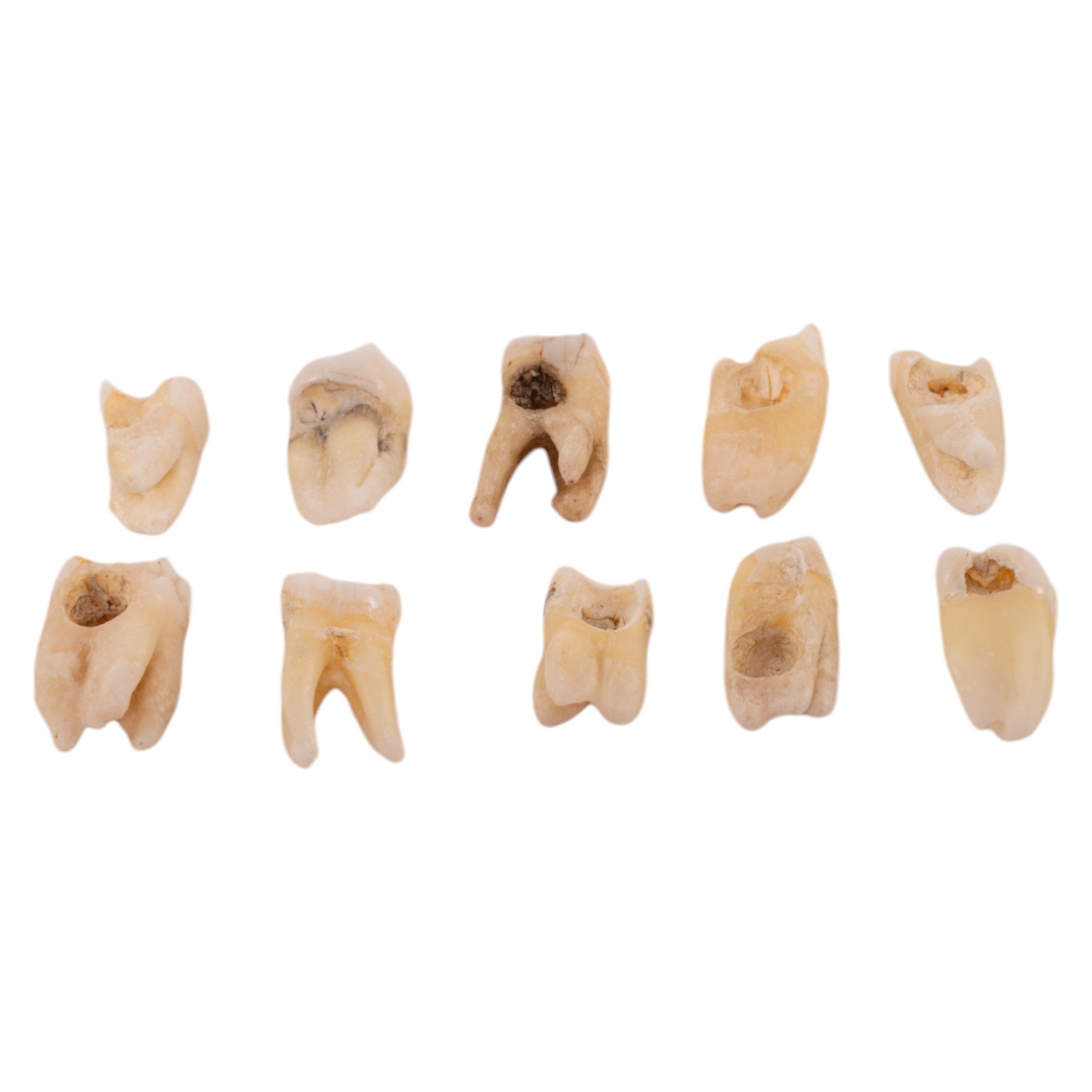 Real Human Molar For Sale — Skulls Unlimited International, Inc.