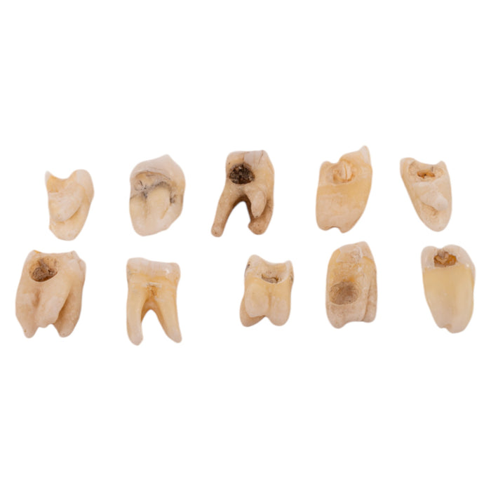 Real Human Molar