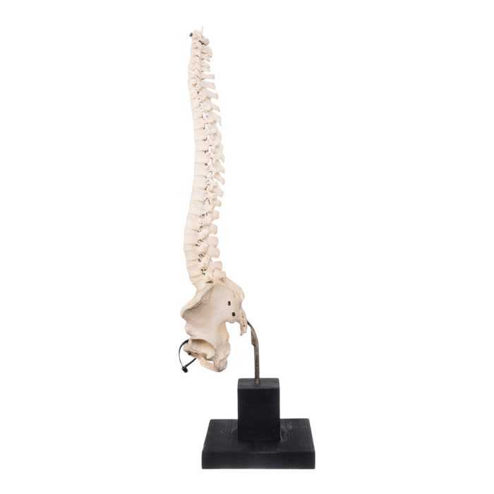 Real Human Spine, Sacrum, and Pelvis on Stand