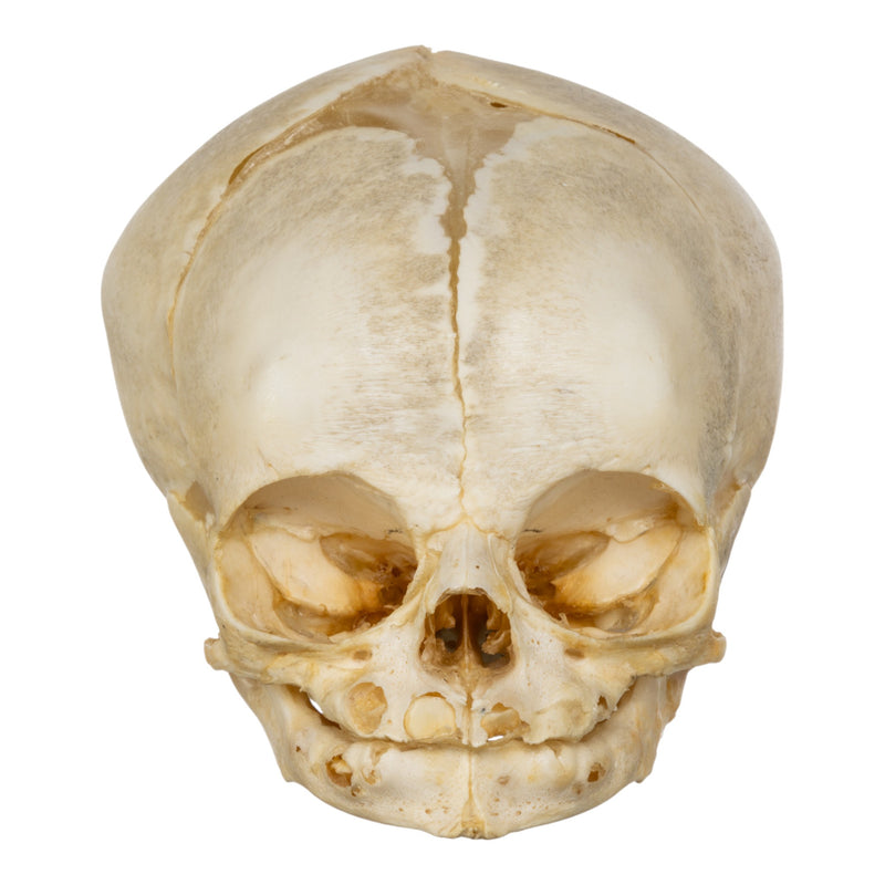 Real Human Fetal Skull