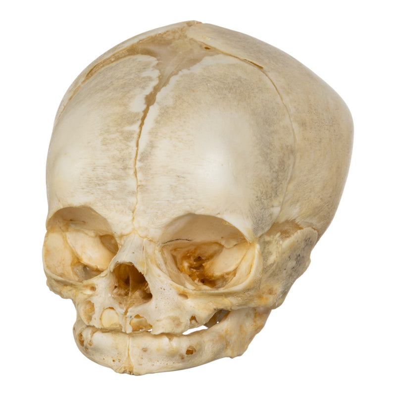 Real Human Fetal Skull