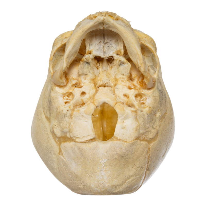Real Human Fetal Skull
