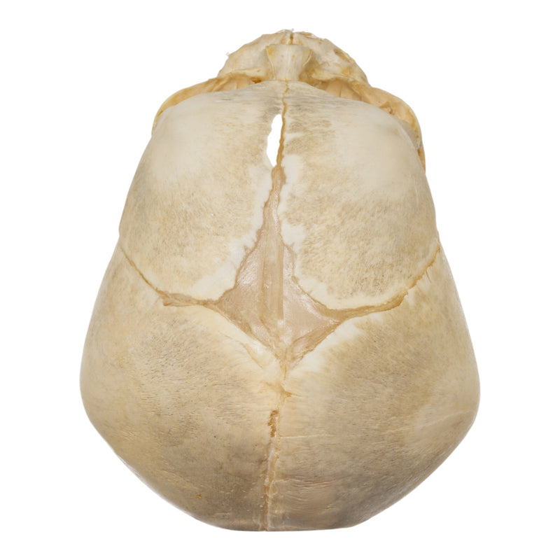Real Human Fetal Skull