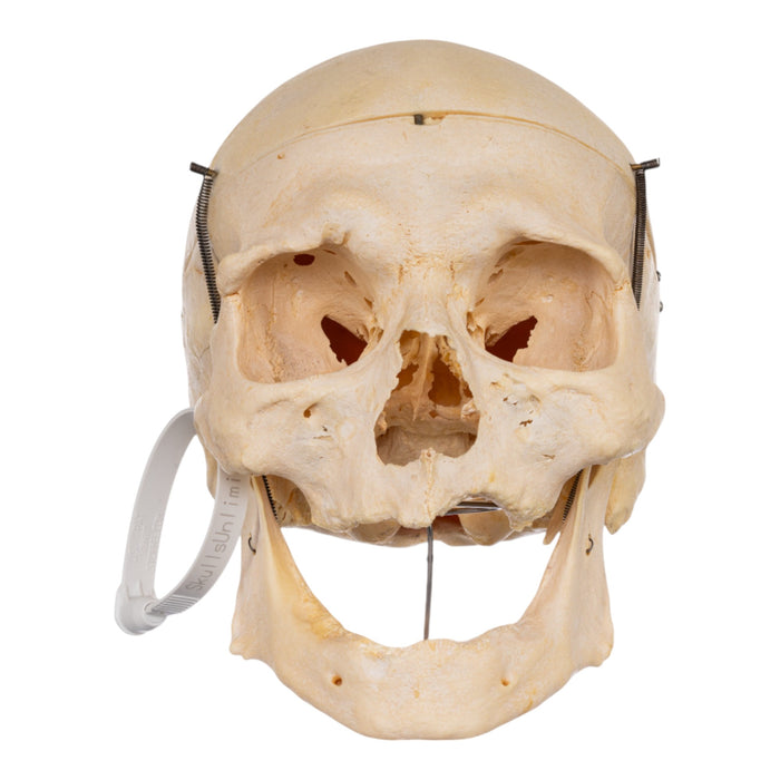 Real Human Skull