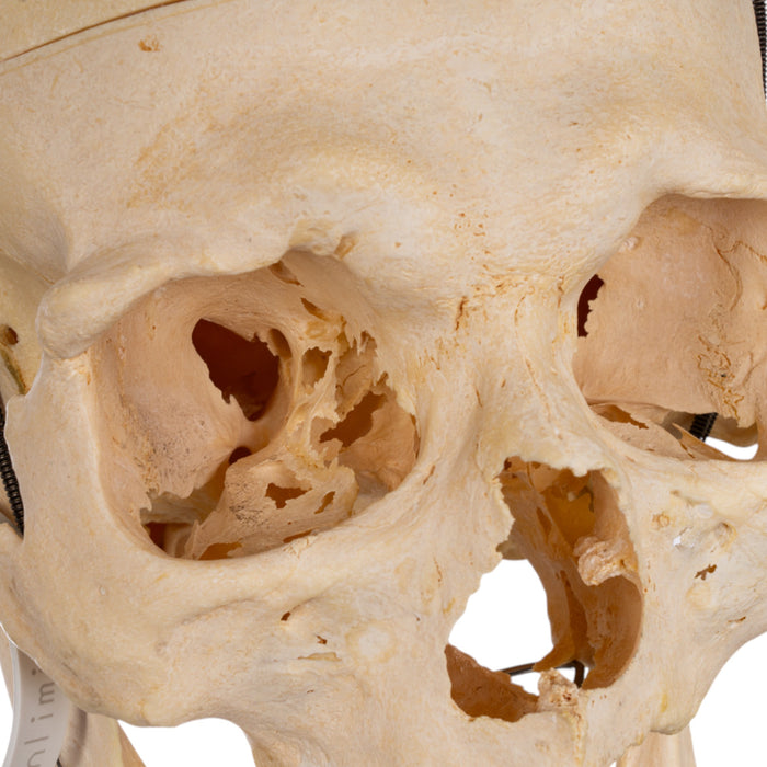 Real Human Skull