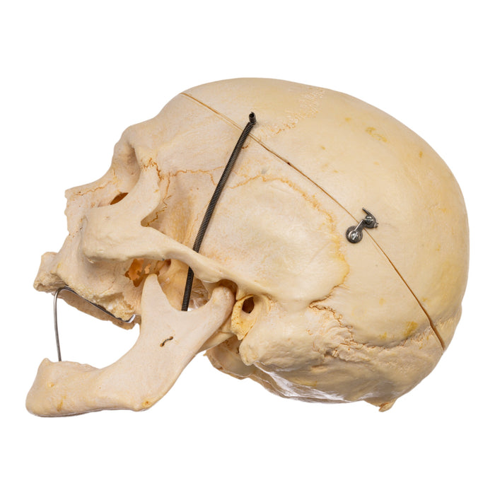 Real Human Skull