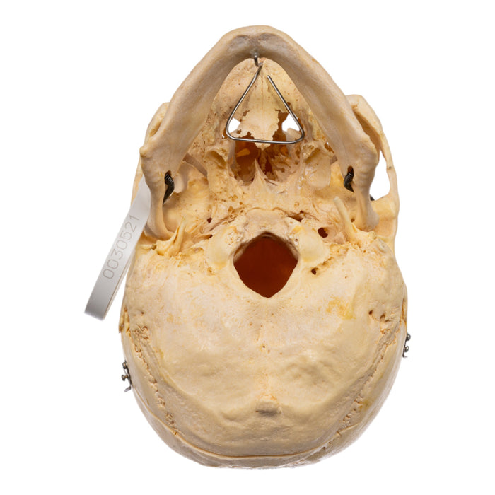Real Human Skull