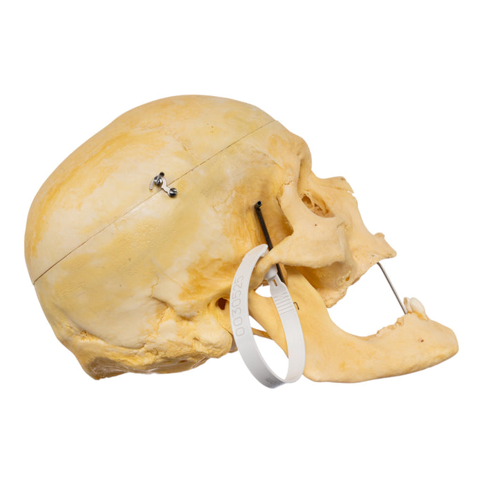 Real Human Skull
