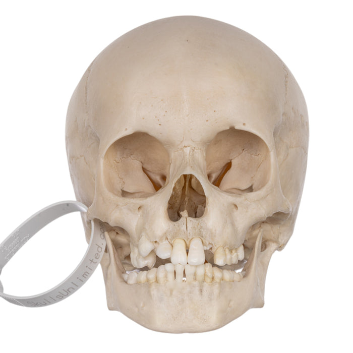 Real Human Child Skull