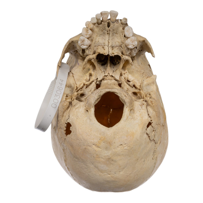 Real Human Child Skull