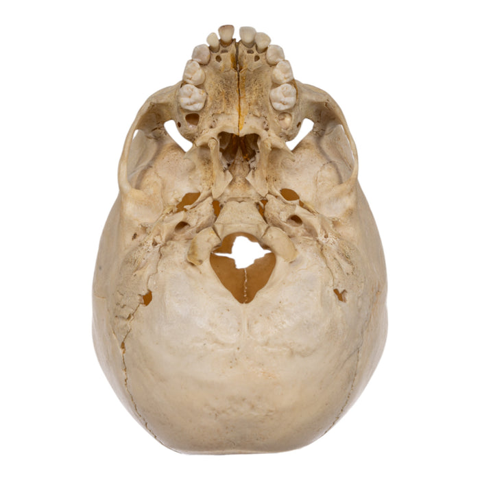 Real Human Child Skull