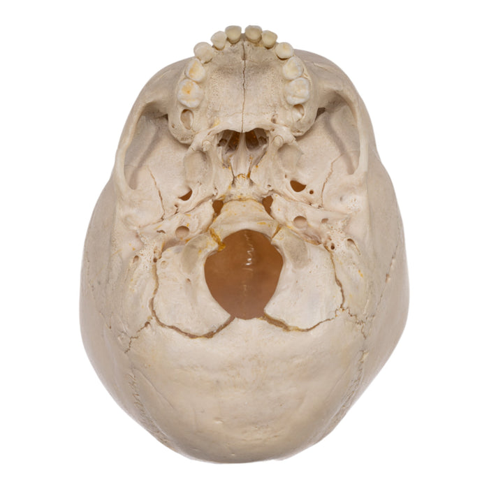 Real Human Child Skull