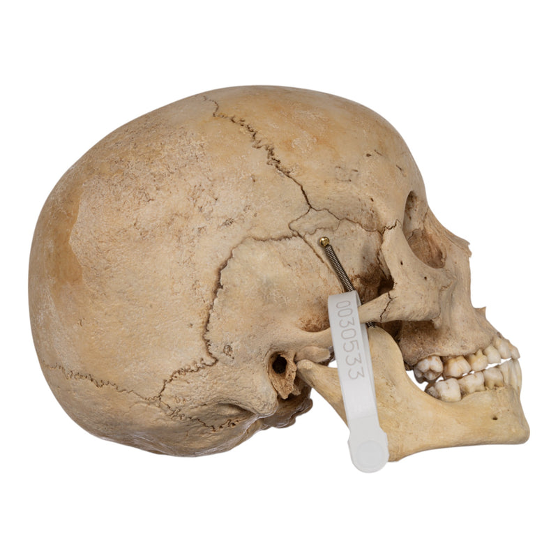 Real Human Child Skull