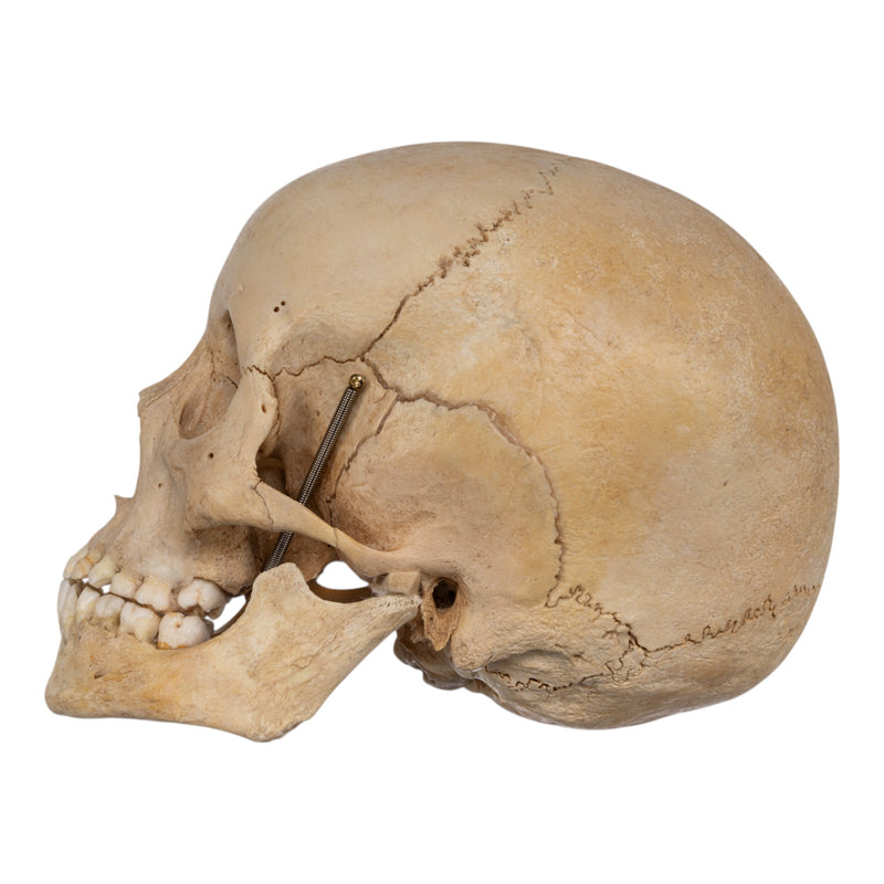 Real Human Child Skull