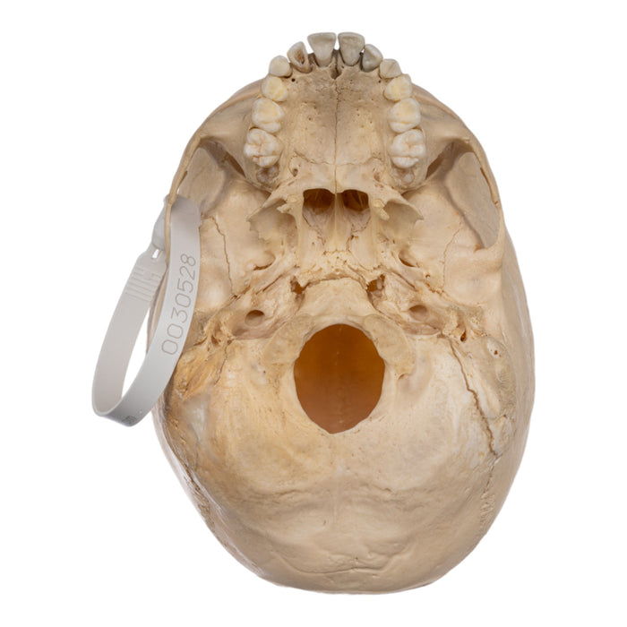 Real Human Child Skull