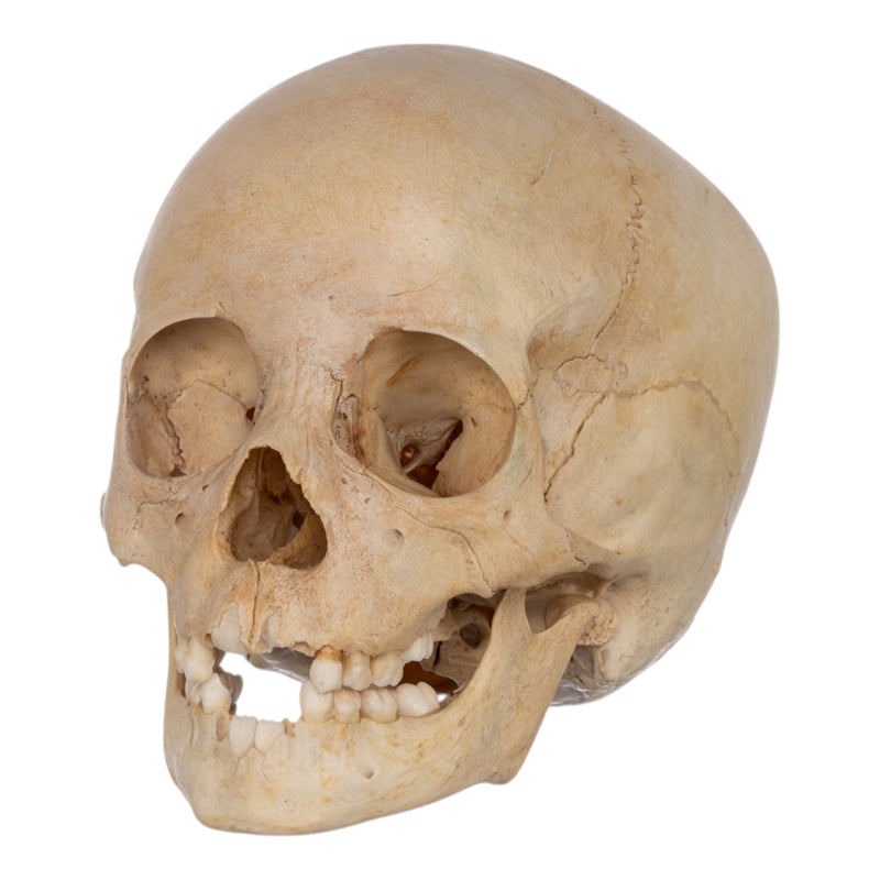 Real Human Child Skull
