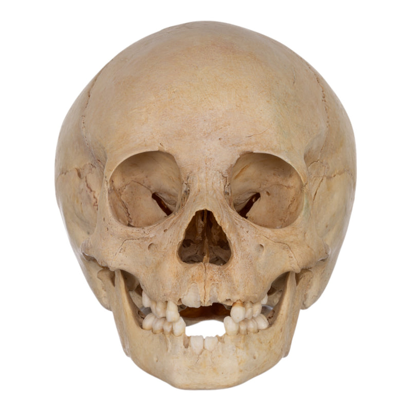 Real Human Child Skull