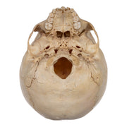 Real Human Child Skull